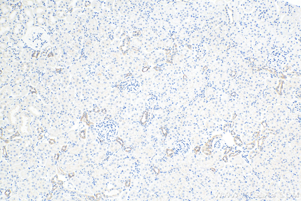Immunohistochemistry (IHC) staining of rat kidney tissue using Cytokeratin 7 Polyclonal antibody (15539-1-AP)