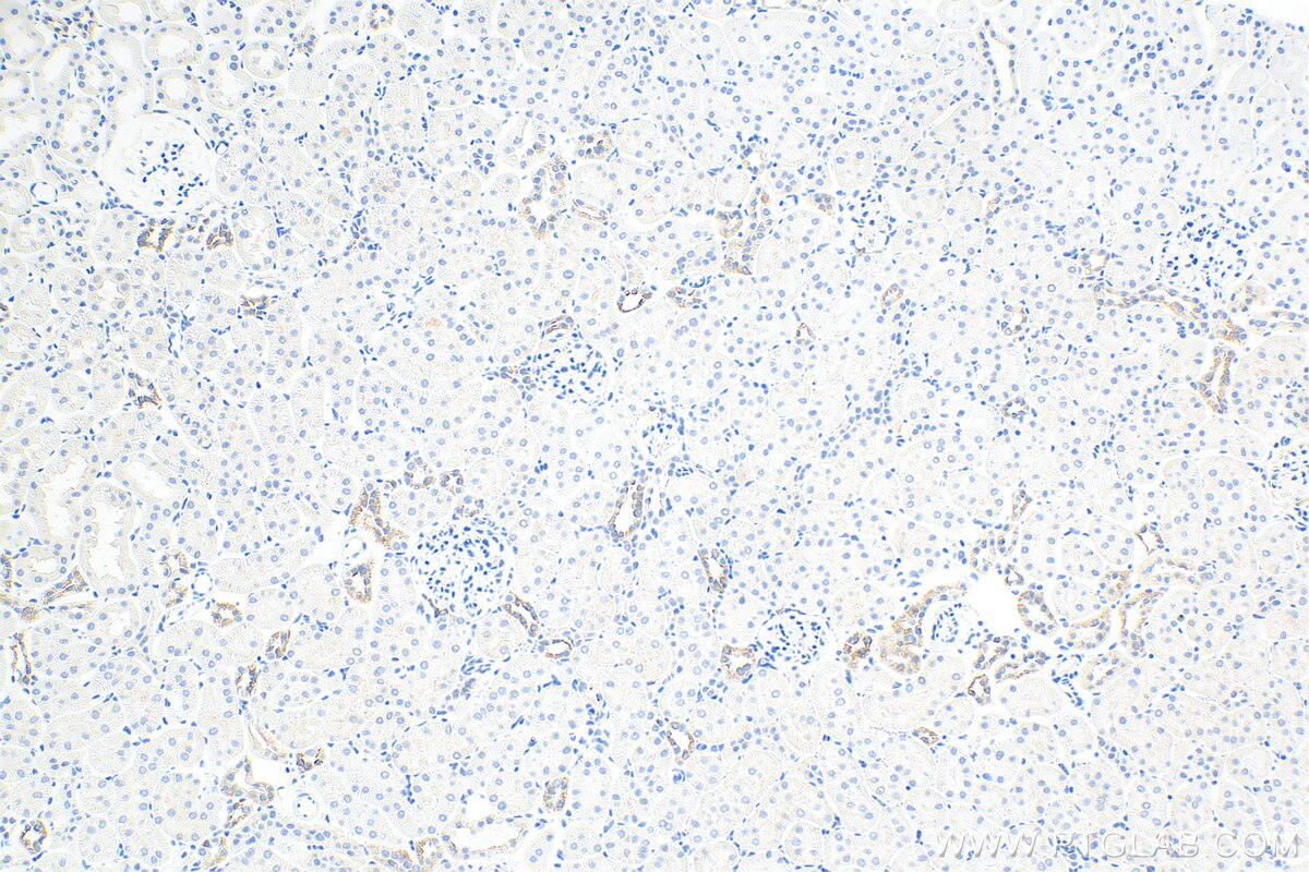 Immunohistochemistry (IHC) staining of rat kidney tissue using Cytokeratin 7 Polyclonal antibody (15539-1-AP)