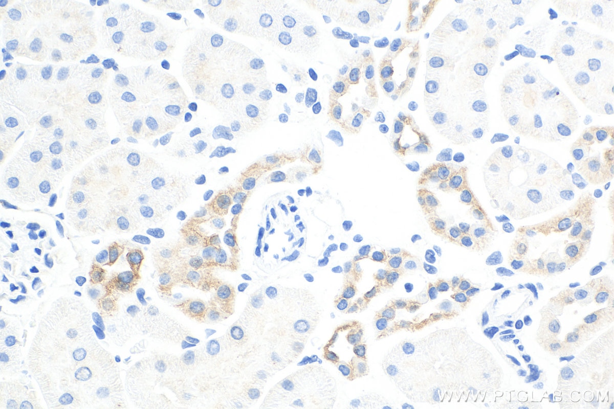 Immunohistochemistry (IHC) staining of rat kidney tissue using Cytokeratin 7 Polyclonal antibody (15539-1-AP)