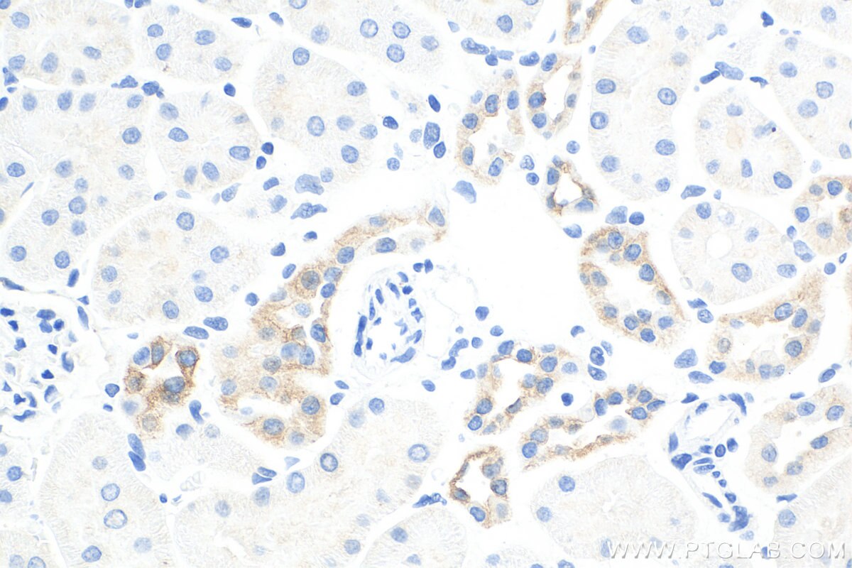 IHC staining of rat kidney using 15539-1-AP