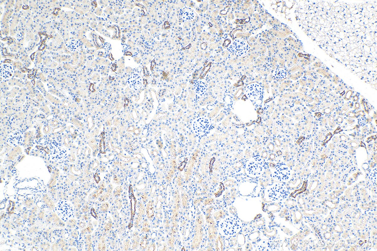 Immunohistochemistry (IHC) staining of mouse kidney tissue using Cytokeratin 7 Polyclonal antibody (15539-1-AP)