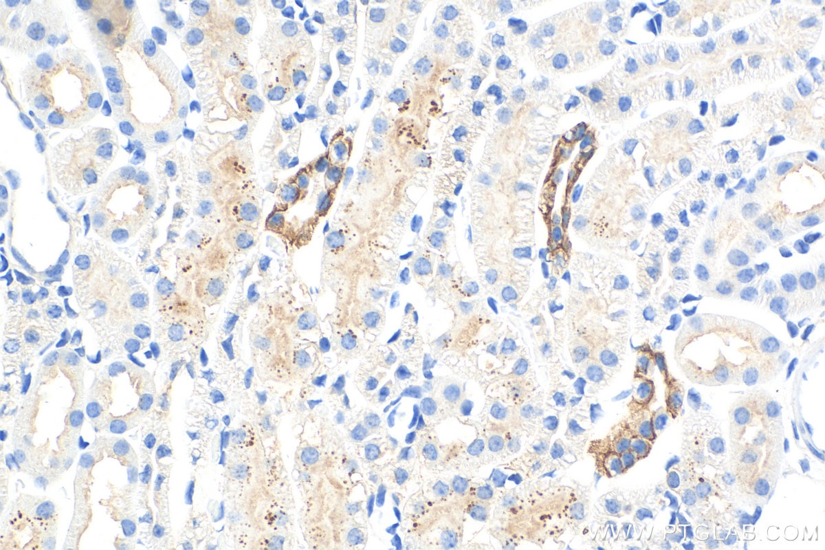 Immunohistochemistry (IHC) staining of mouse kidney tissue using Cytokeratin 7 Polyclonal antibody (15539-1-AP)