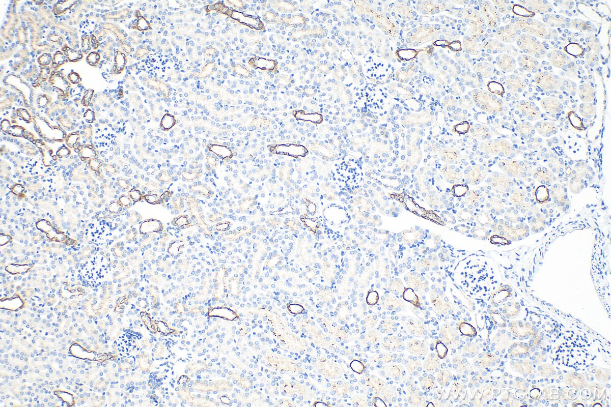 Immunohistochemistry (IHC) staining of mouse kidney tissue using Cytokeratin 7 Polyclonal antibody (15539-1-AP)