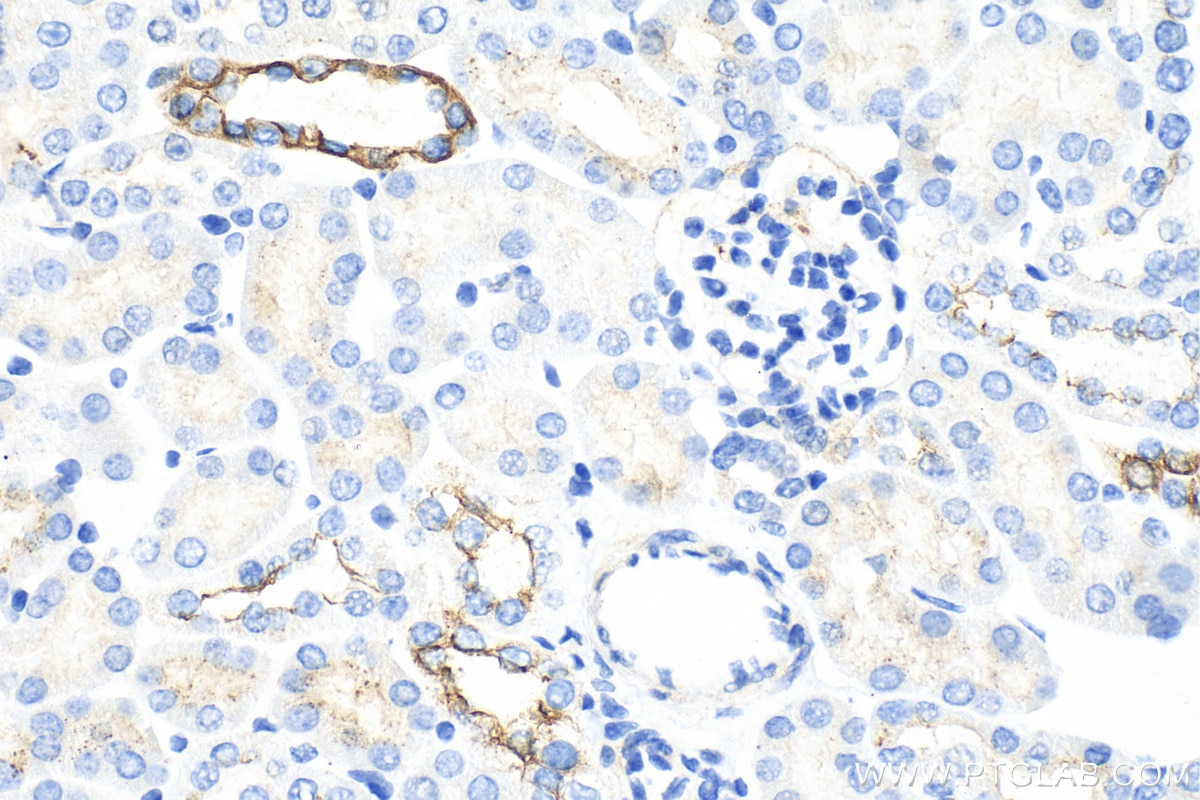 Immunohistochemistry (IHC) staining of mouse kidney tissue using Cytokeratin 7 Polyclonal antibody (15539-1-AP)
