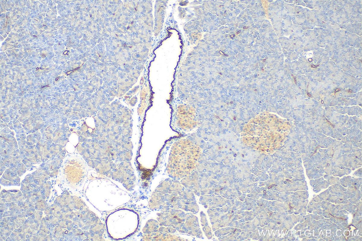Immunohistochemistry (IHC) staining of mouse pancreas tissue using Cytokeratin 7 Polyclonal antibody (15539-1-AP)