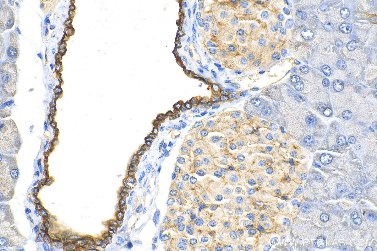 Immunohistochemistry (IHC) staining of mouse pancreas tissue using Cytokeratin 7 Polyclonal antibody (15539-1-AP)