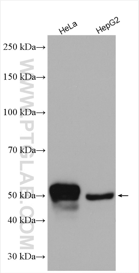 Western Blot (WB) analysis of various lysates using Cytokeratin 7 Polyclonal antibody (15539-1-AP)