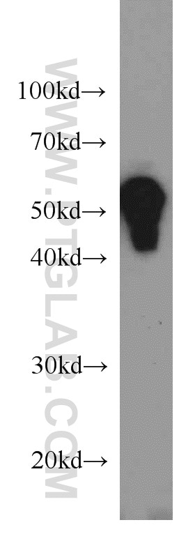 Western Blot (WB) analysis of HeLa cells using Cytokeratin 7 Polyclonal antibody (15539-1-AP)