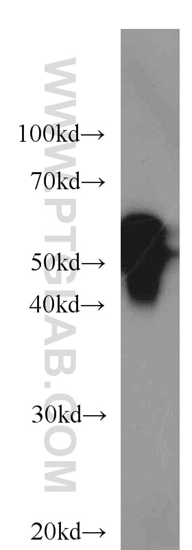 Western Blot (WB) analysis of A431 cells using Cytokeratin 7 Polyclonal antibody (15539-1-AP)