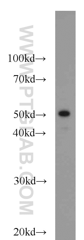 Western Blot (WB) analysis of mouse liver tissue using Cytokeratin 7 Polyclonal antibody (15539-1-AP)