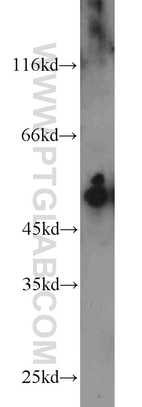 Western Blot (WB) analysis of rat liver tissue using Cytokeratin 7 Polyclonal antibody (15539-1-AP)