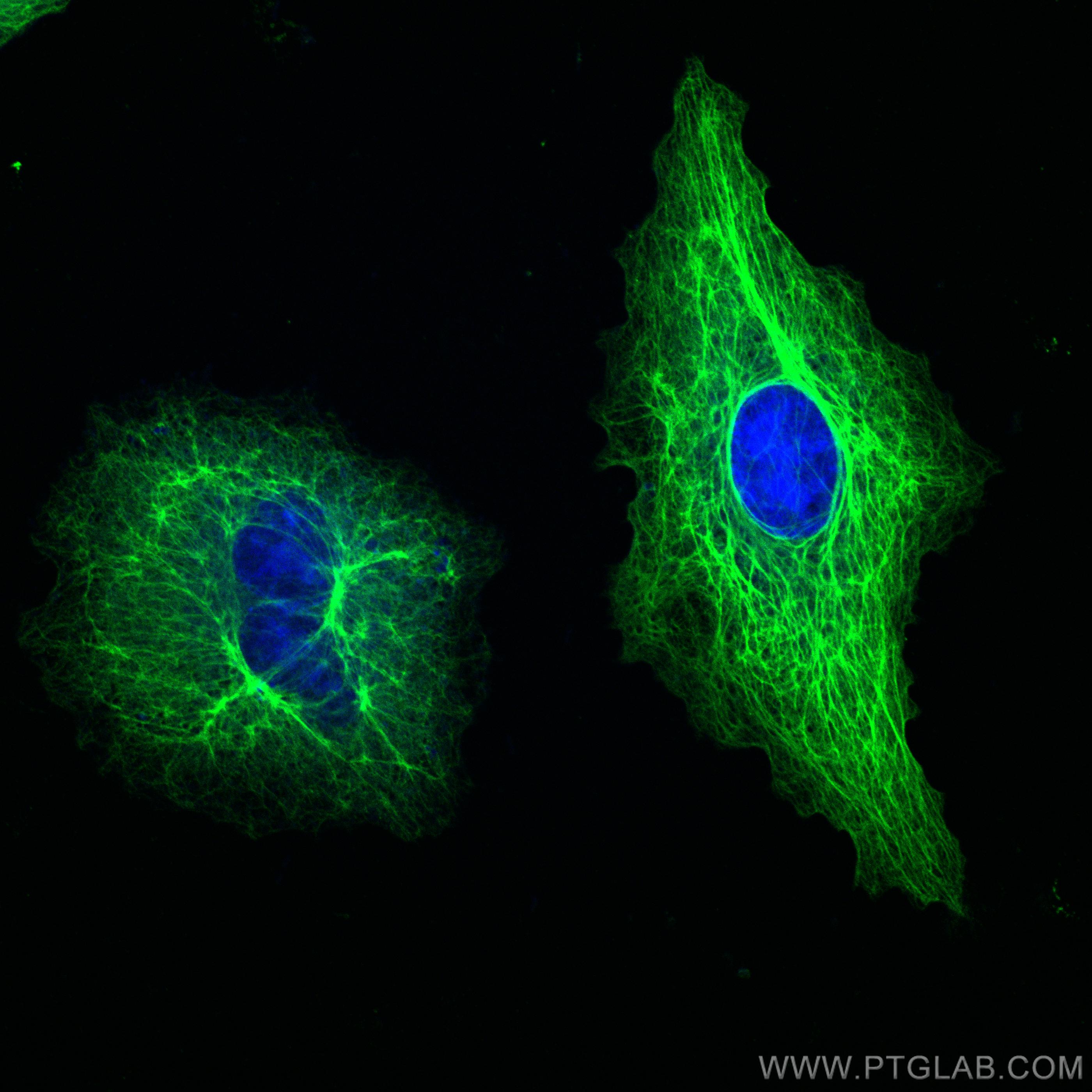 Immunofluorescence (IF) / fluorescent staining of A549 cells using Cytokeratin 7 Polyclonal antibody (22208-1-AP)