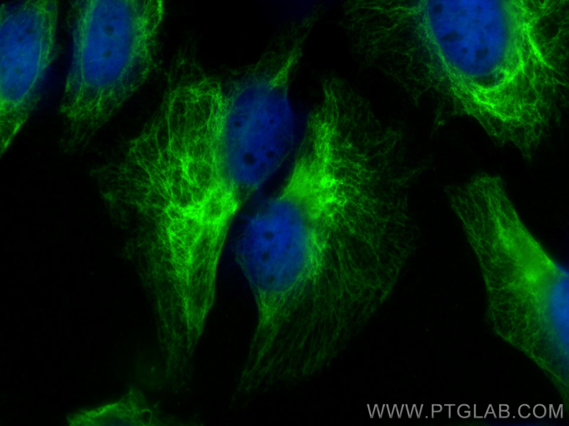 Immunofluorescence (IF) / fluorescent staining of HeLa cells using Cytokeratin 7 Polyclonal antibody (22208-1-AP)