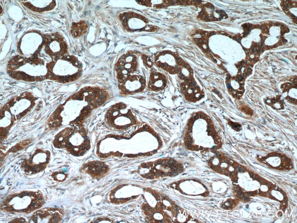 Cytokeratin 7 Polyclonal antibody