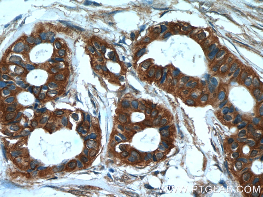 Cytokeratin 7 Polyclonal antibody