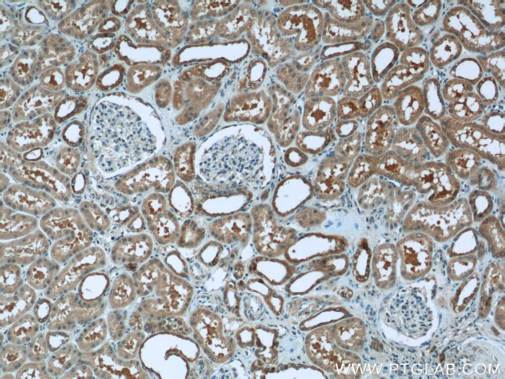 Immunohistochemistry (IHC) staining of human kidney tissue using Cytokeratin 7 Polyclonal antibody (22208-1-AP)