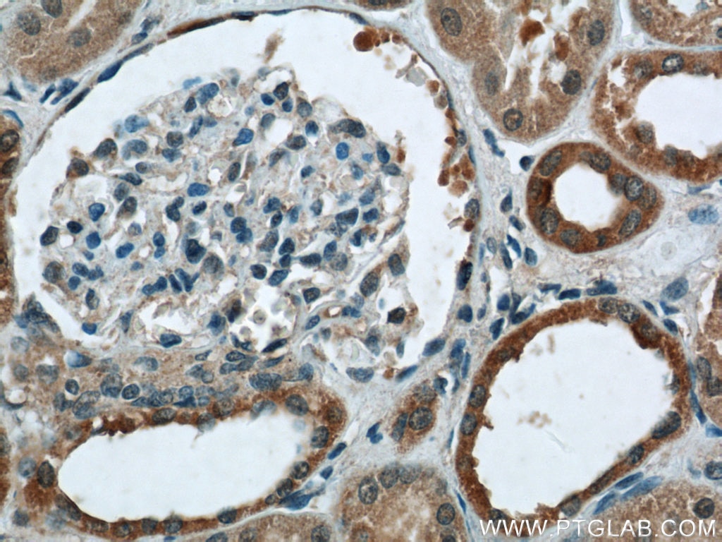 Immunohistochemistry (IHC) staining of human kidney tissue using Cytokeratin 7 Polyclonal antibody (22208-1-AP)