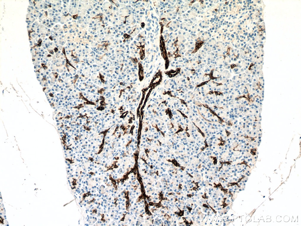 Immunohistochemistry (IHC) staining of human pancreas tissue using Cytokeratin 7 Polyclonal antibody (22208-1-AP)