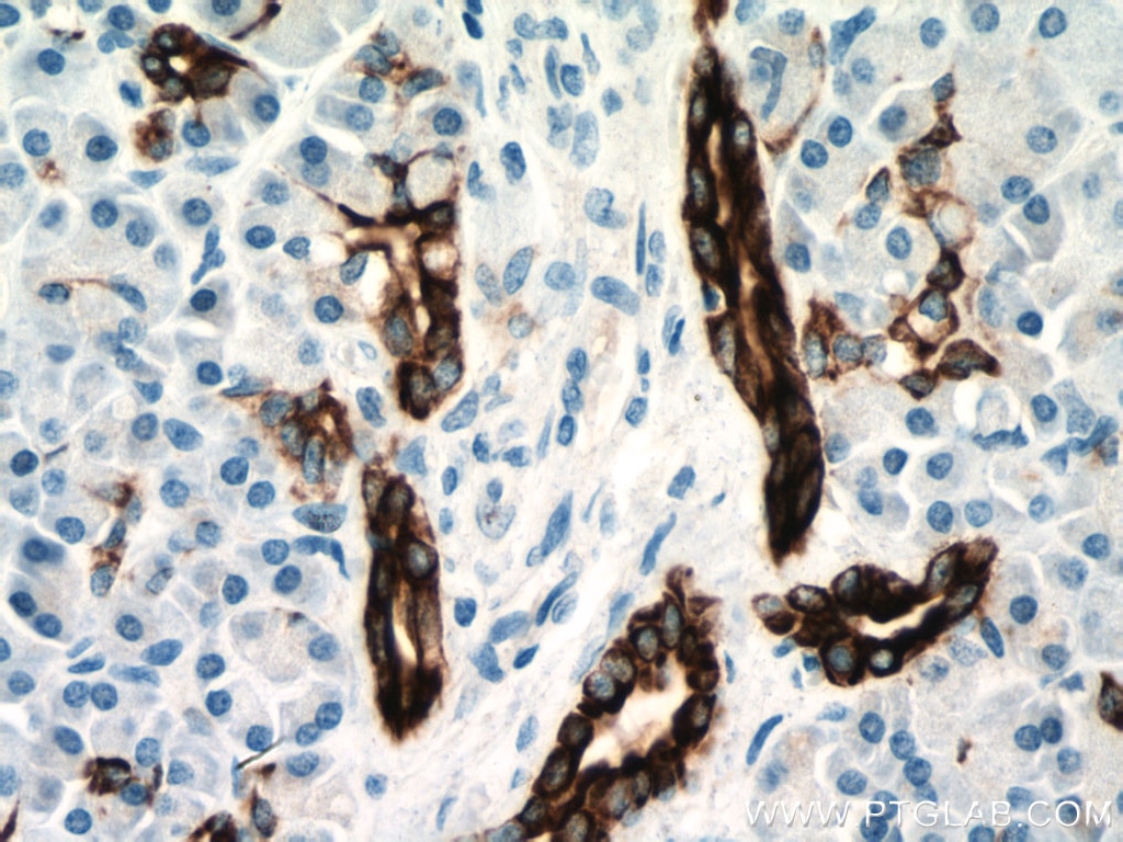 Immunohistochemistry (IHC) staining of human pancreas tissue using Cytokeratin 7 Polyclonal antibody (22208-1-AP)