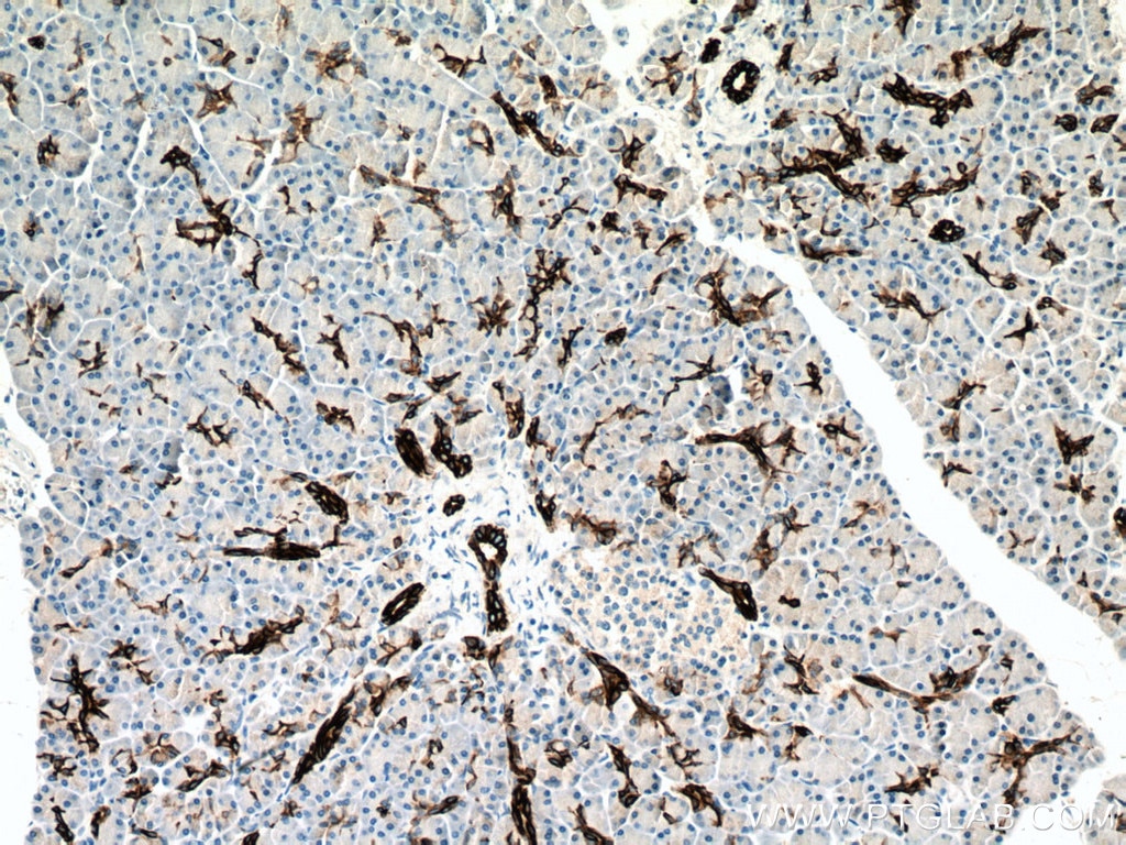 Immunohistochemistry (IHC) staining of human pancreas tissue using Cytokeratin 7 Polyclonal antibody (22208-1-AP)