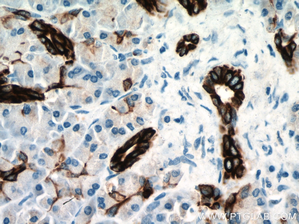 Immunohistochemistry (IHC) staining of human pancreas tissue using Cytokeratin 7 Polyclonal antibody (22208-1-AP)