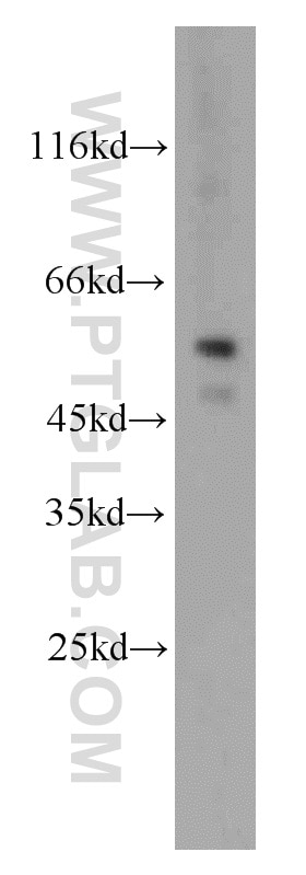 Western Blot (WB) analysis of HepG2 cells using Cytokeratin 7 Polyclonal antibody (22208-1-AP)