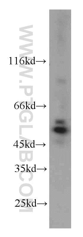 Western Blot (WB) analysis of A431 cells using Cytokeratin 7 Polyclonal antibody (22208-1-AP)