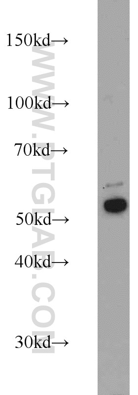 Western Blot (WB) analysis of A431 cells using Cytokeratin 7 Polyclonal antibody (22208-1-AP)