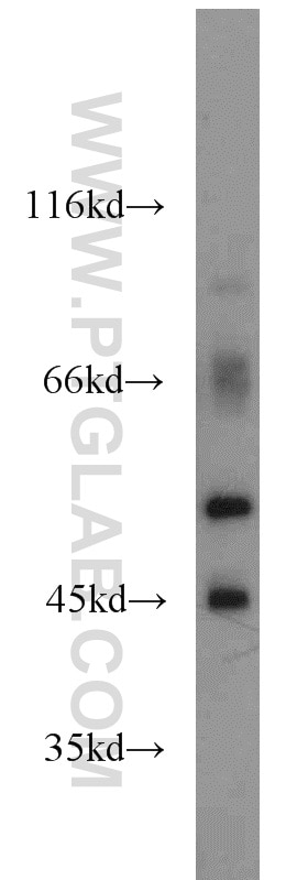 Western Blot (WB) analysis of HeLa cells using Cytokeratin 7 Polyclonal antibody (22208-1-AP)