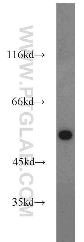 Western Blot (WB) analysis of HepG2 cells using Cytokeratin 7 Polyclonal antibody (22208-1-AP)