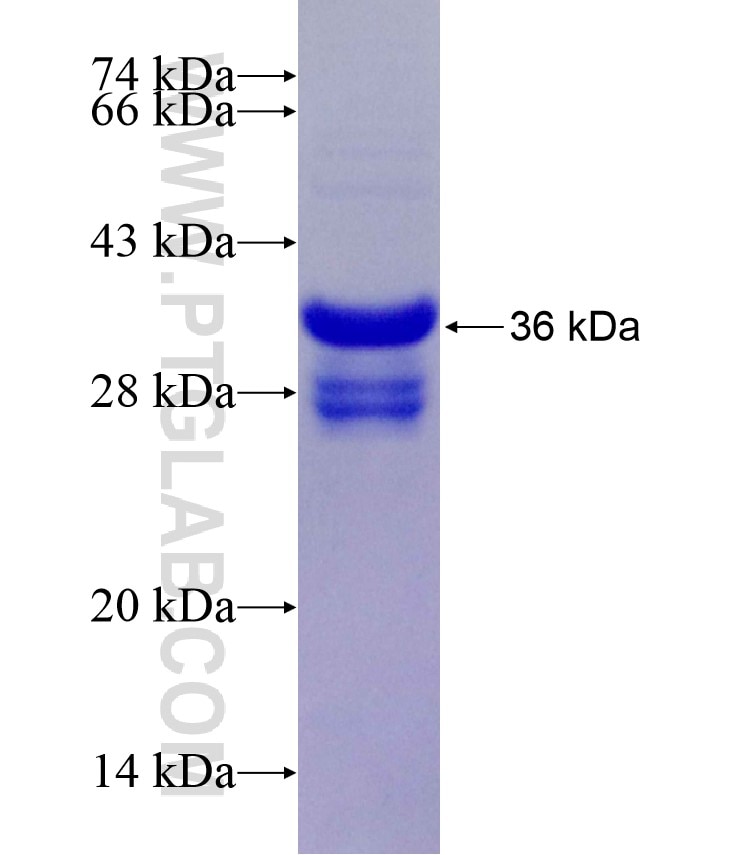 KRT7 fusion protein Ag17528 SDS-PAGE