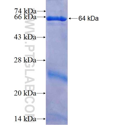 CK7 fusion protein Ag7895 SDS-PAGE