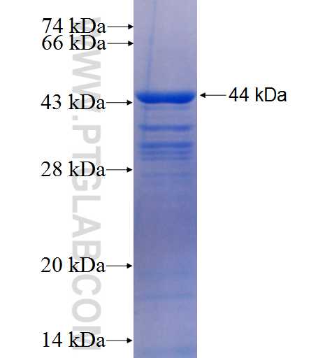 CK7 fusion protein Ag8520 SDS-PAGE