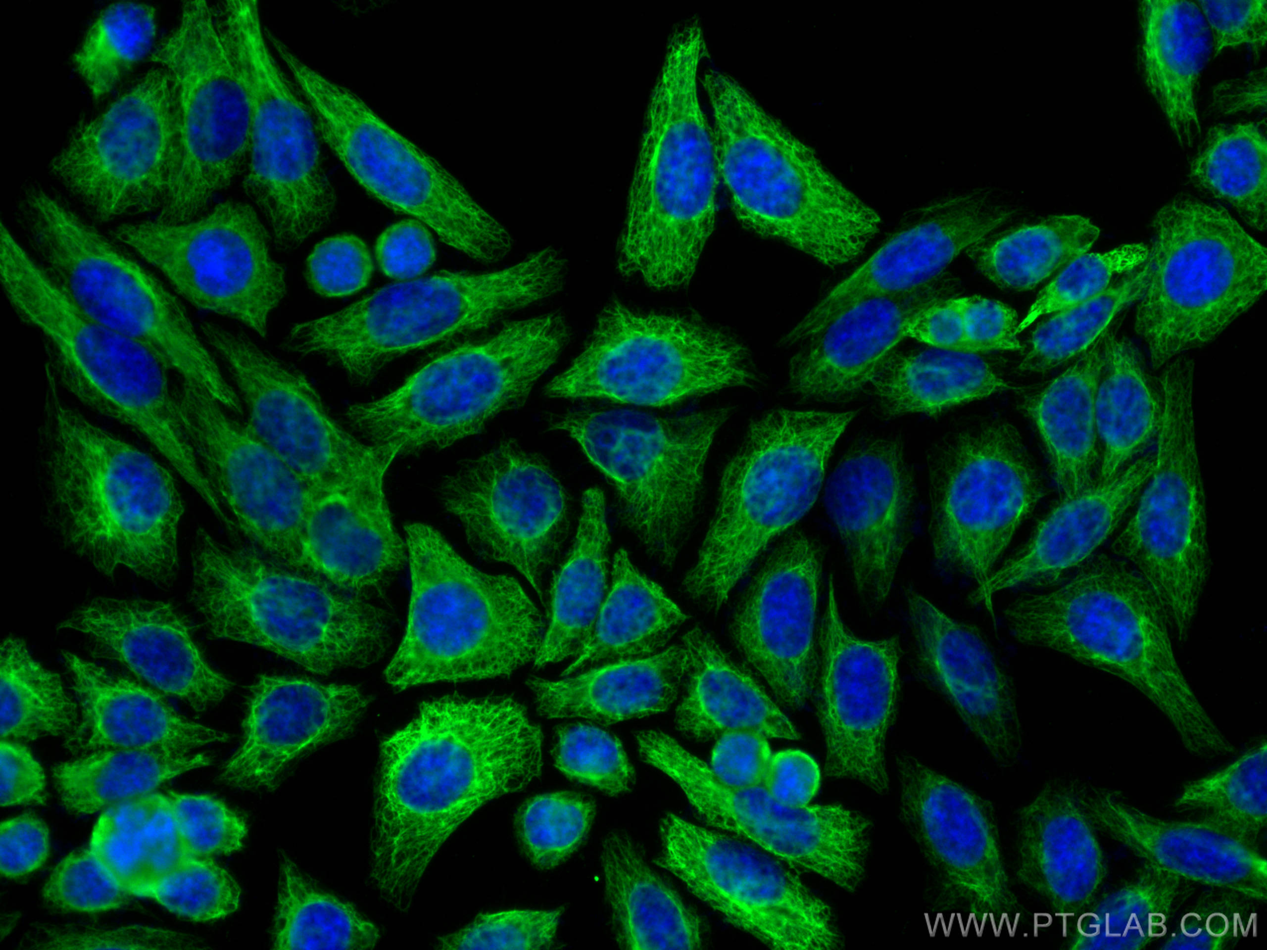 Immunofluorescence (IF) / fluorescent staining of HepG2 cells using Cytokeratin 7-specific Polyclonal antibody (17513-1-AP)