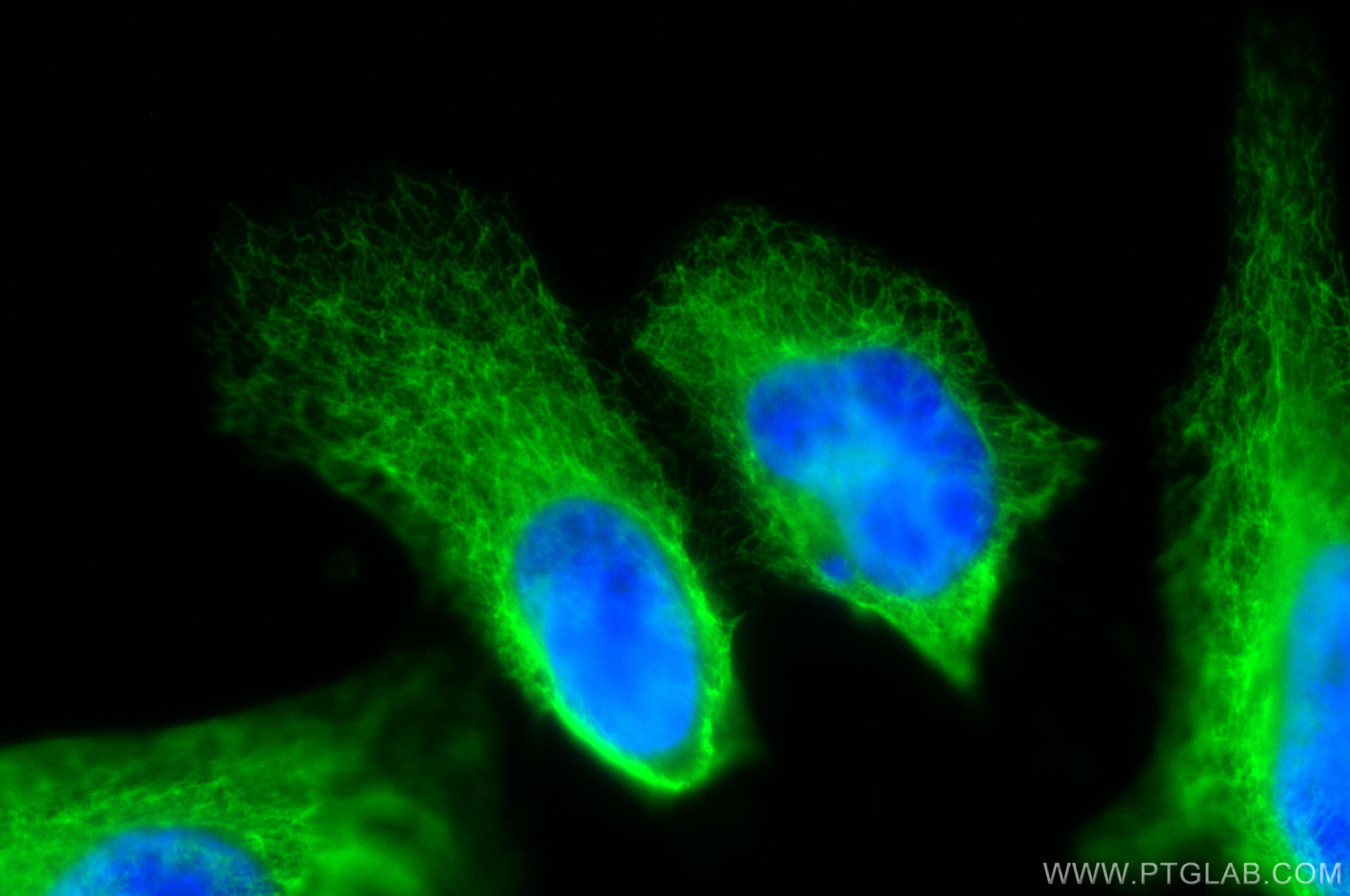 Immunofluorescence (IF) / fluorescent staining of HeLa cells using Cytokeratin 7-specific Polyclonal antibody (17513-1-AP)