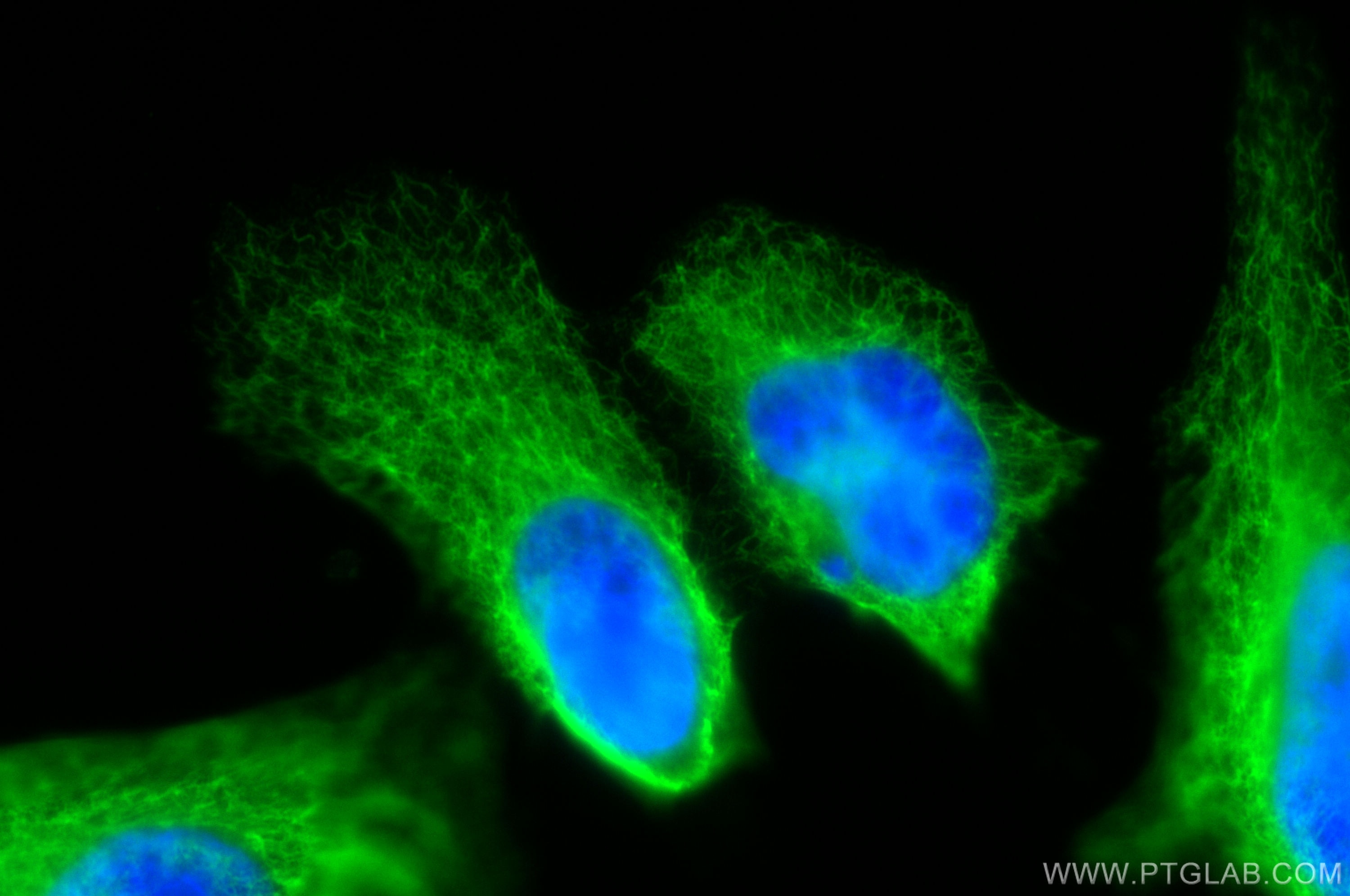 IF Staining of HeLa using 17513-1-AP