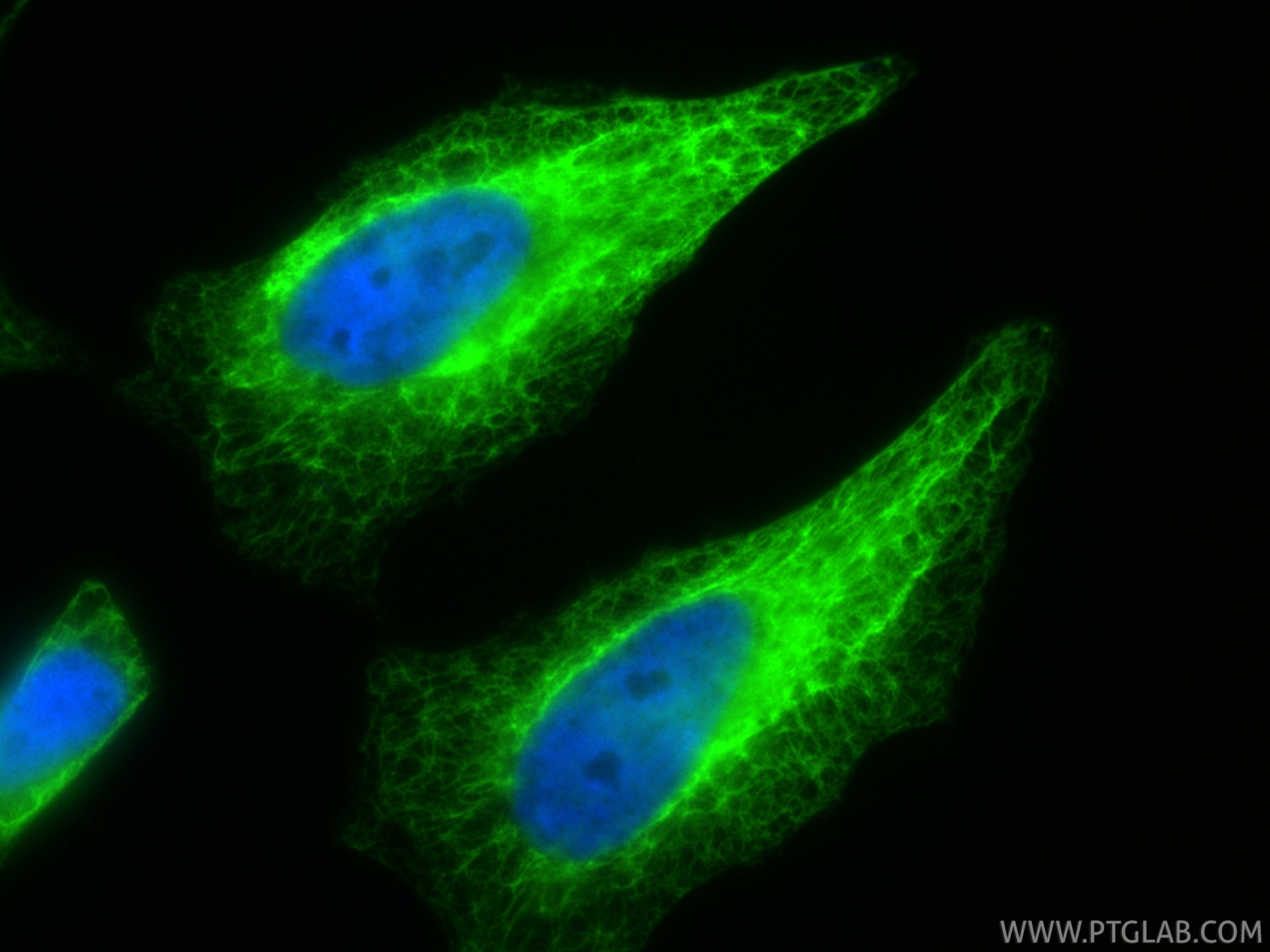 Immunofluorescence (IF) / fluorescent staining of HeLa cells using Cytokeratin 7-specific Polyclonal antibody (17513-1-AP)