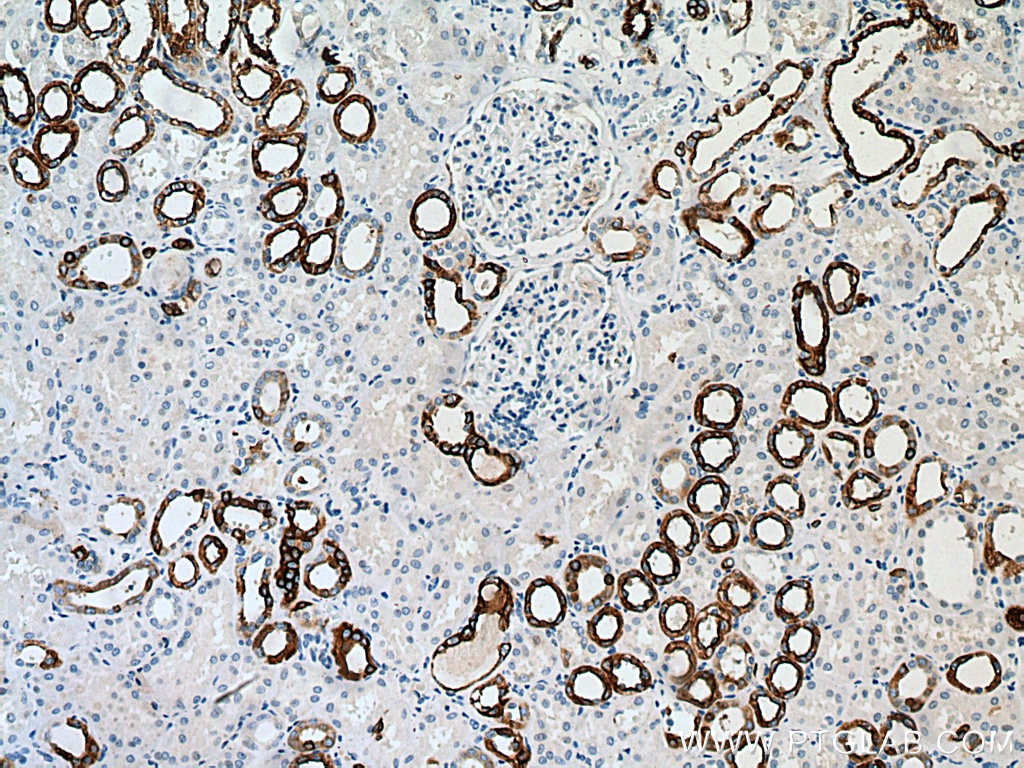 Immunohistochemistry (IHC) staining of human kidney tissue using Cytokeratin 7-specific Polyclonal antibody (17513-1-AP)