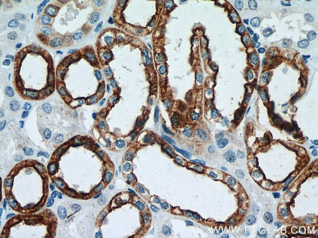 Immunohistochemistry (IHC) staining of human kidney tissue using Cytokeratin 7-specific Polyclonal antibody (17513-1-AP)