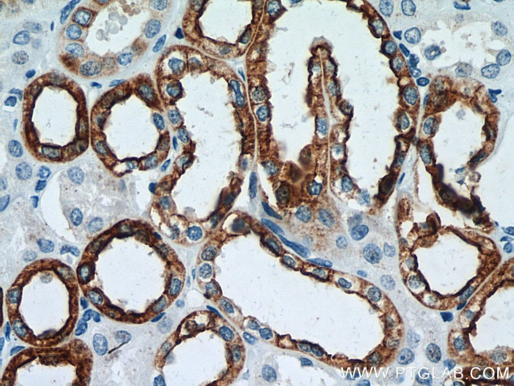 IHC staining of human kidney using 17513-1-AP