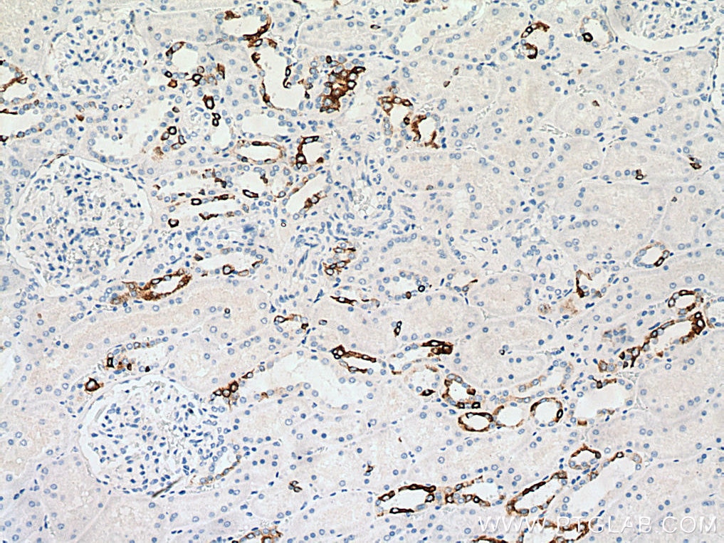 Immunohistochemistry (IHC) staining of human kidney tissue using Cytokeratin 7-specific Polyclonal antibody (17513-1-AP)