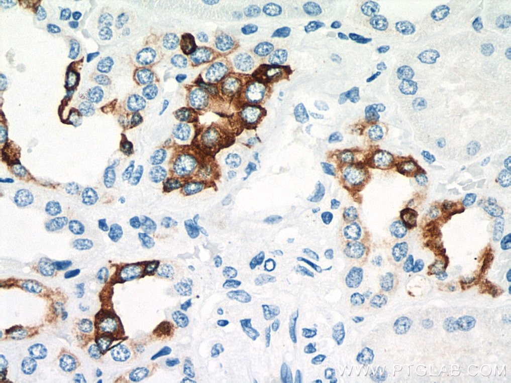 Immunohistochemistry (IHC) staining of human kidney tissue using Cytokeratin 7-specific Polyclonal antibody (17513-1-AP)