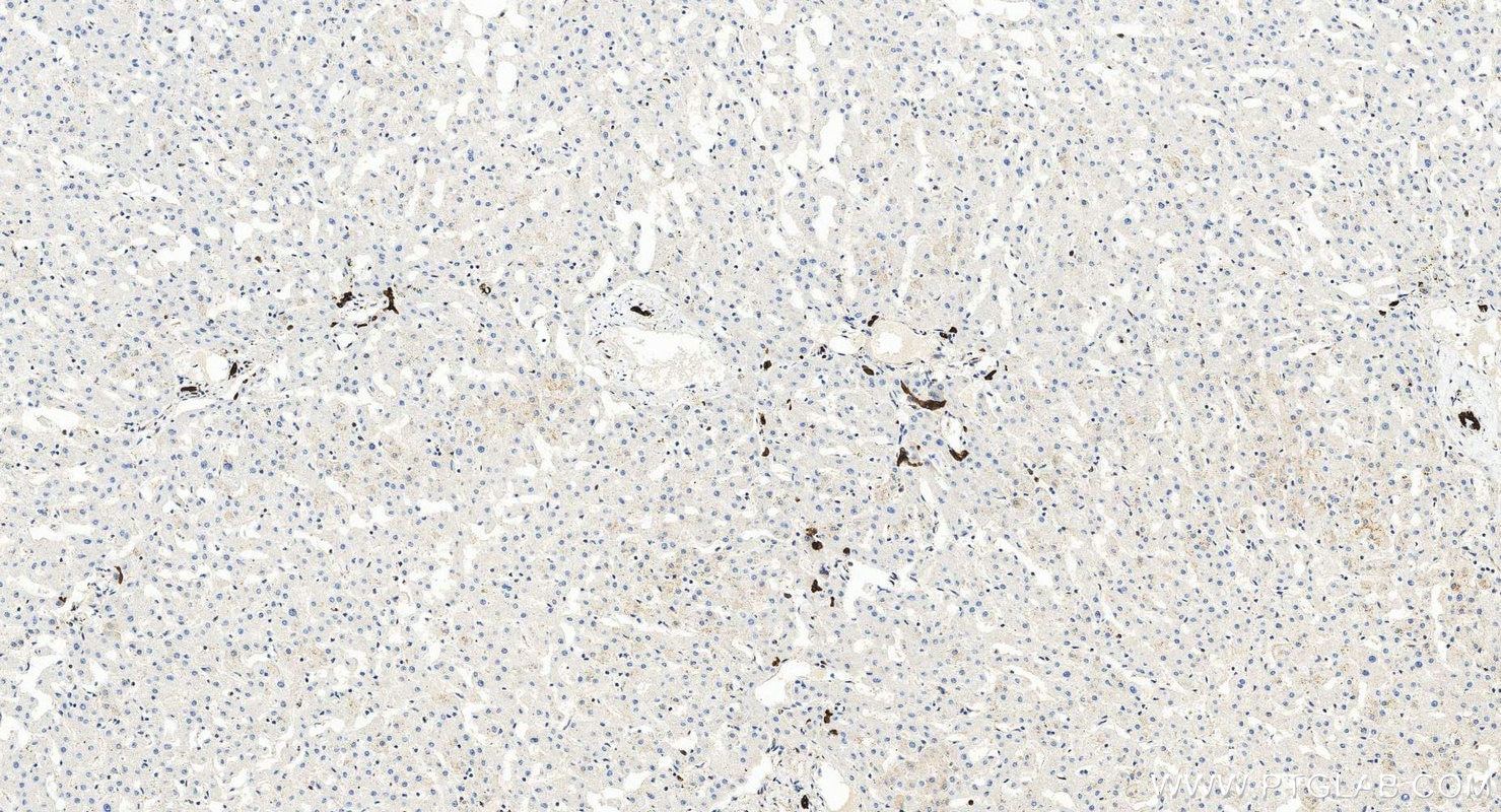 IHC staining of human liver using 17513-1-AP Immunohistochemistry (IHC) staining of human liver tissue using Cytokeratin 7-specific Polyclonal antibody (17513-1-AP)