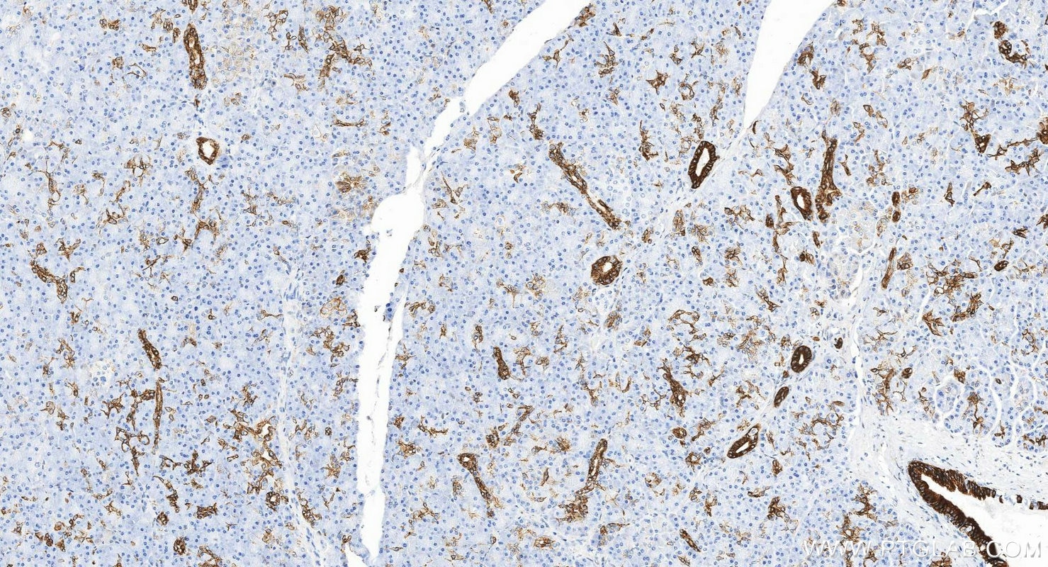 IHC staining of human pancreas using 17513-1-AP Immunohistochemistry (IHC) staining of human pancreas tissue using Cytokeratin 7-specific Polyclonal antibody (17513-1-AP)