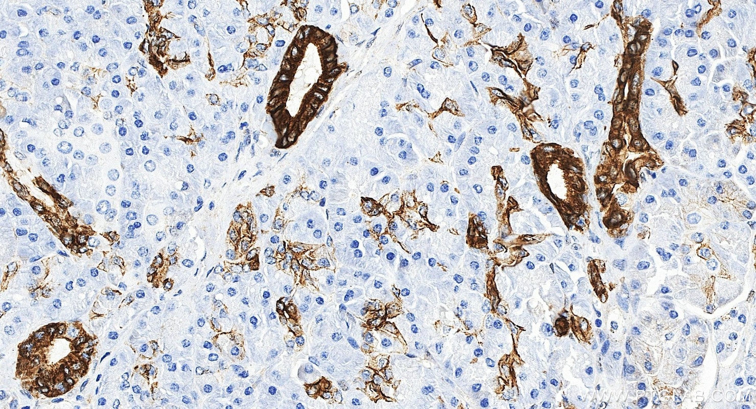 IHC staining of human pancreas using 17513-1-AP Immunohistochemistry (IHC) staining of human pancreas tissue using Cytokeratin 7-specific Polyclonal antibody (17513-1-AP)