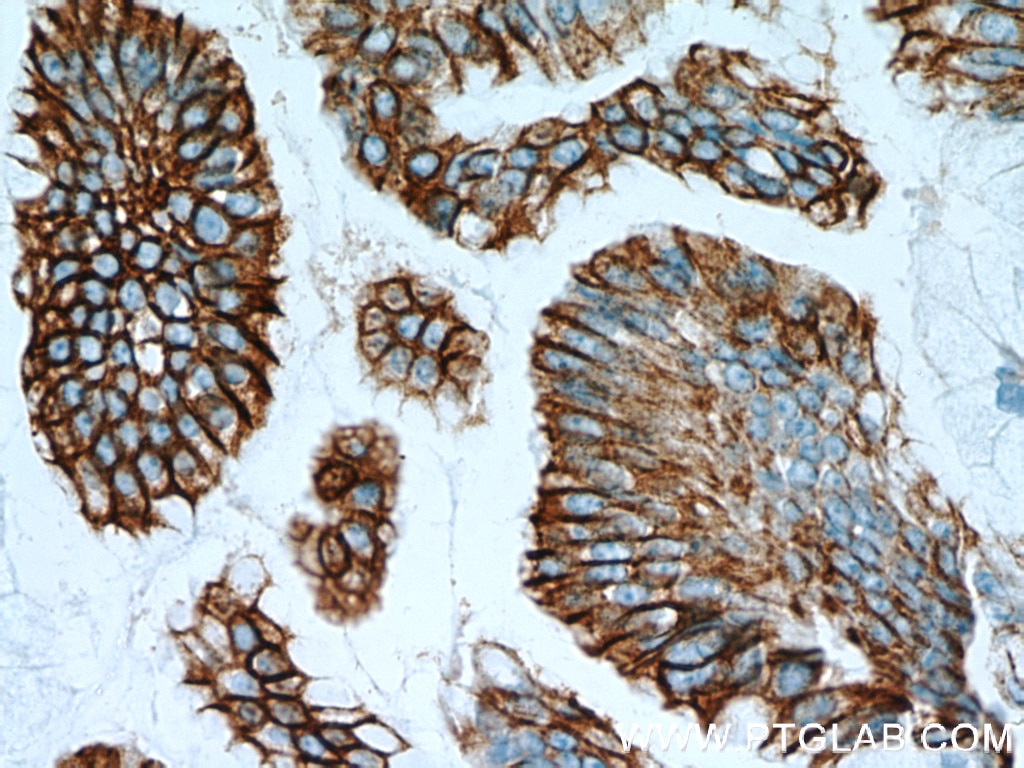 Cytokeratin 7-specific Polyclonal antibody