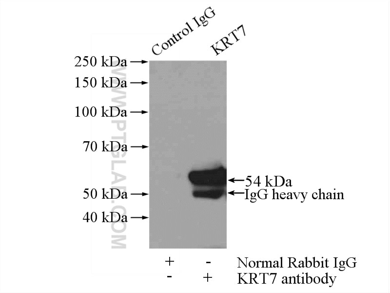 Immunoprecipitation (IP) experiment of HepG2 cells using Cytokeratin 7-specific Polyclonal antibody (17513-1-AP)