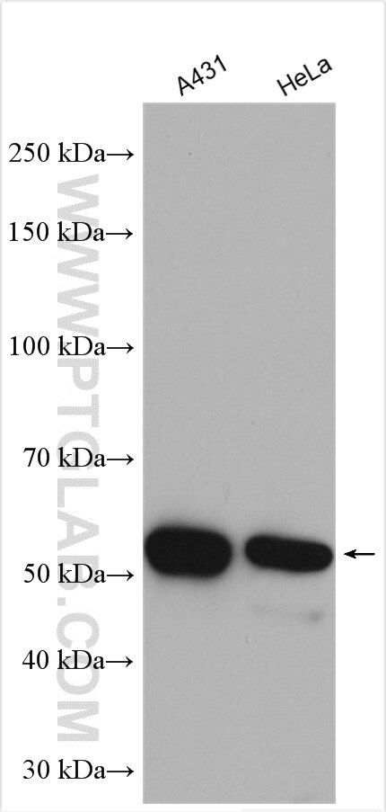Western Blot (WB) analysis of various lysates using Cytokeratin 7-specific Polyclonal antibody (17513-1-AP)