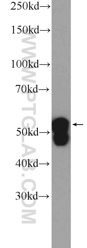 Western Blot (WB) analysis of HeLa cells using Cytokeratin 7-specific Polyclonal antibody (17513-1-AP)