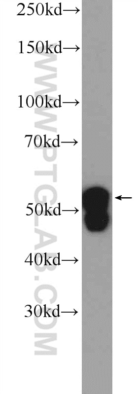 WB analysis of HeLa using 17513-1-AP